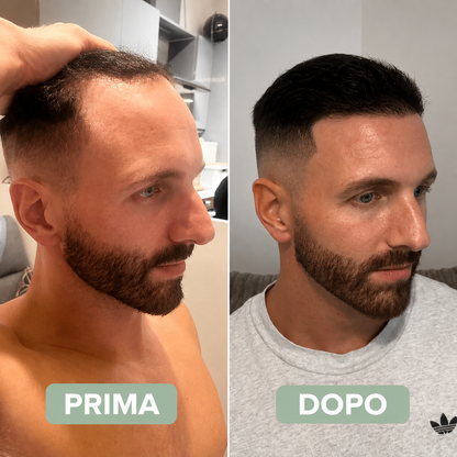 TH - Siero per la ricrescita dei capelli