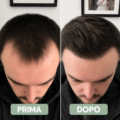 TH - Siero per la ricrescita dei capelli